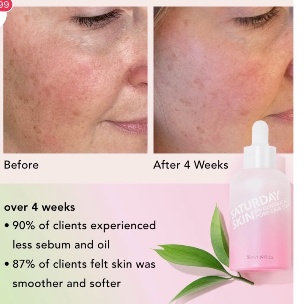 Saturday Skin 4% Glycolic Pore Active Treatment - Picture 3 of 5
